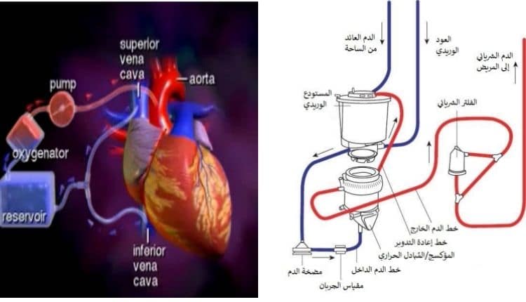 جهاز عمليات القلب المفتوح في جراحة القلب