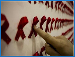 الختان يقلل خطر الاصابة بالأيدز