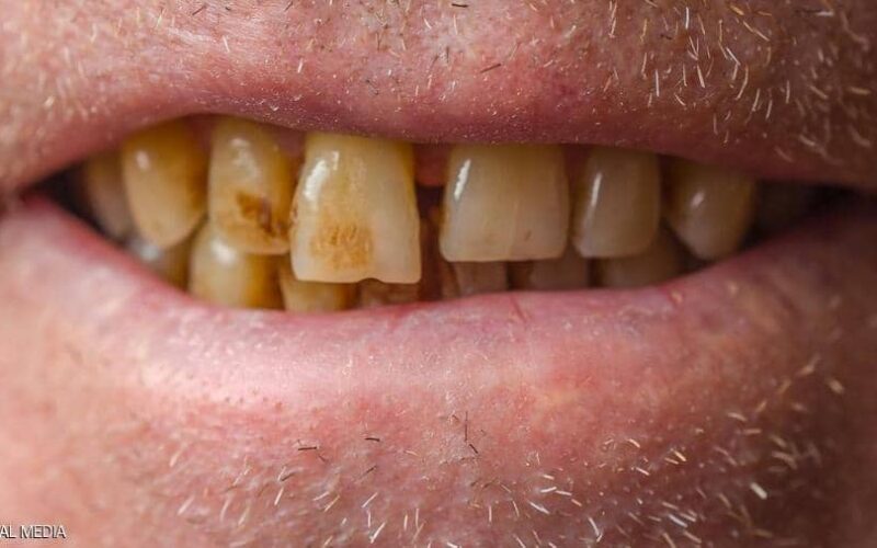 كيف تحافظ على اسنانك من تصبغات القهوة ؟