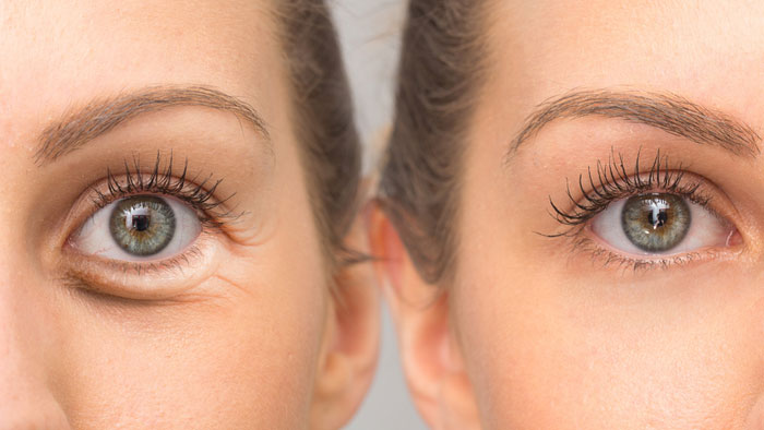 كريمات فعالة لحماية العين من التجاعيد واعراض الشيخوخة