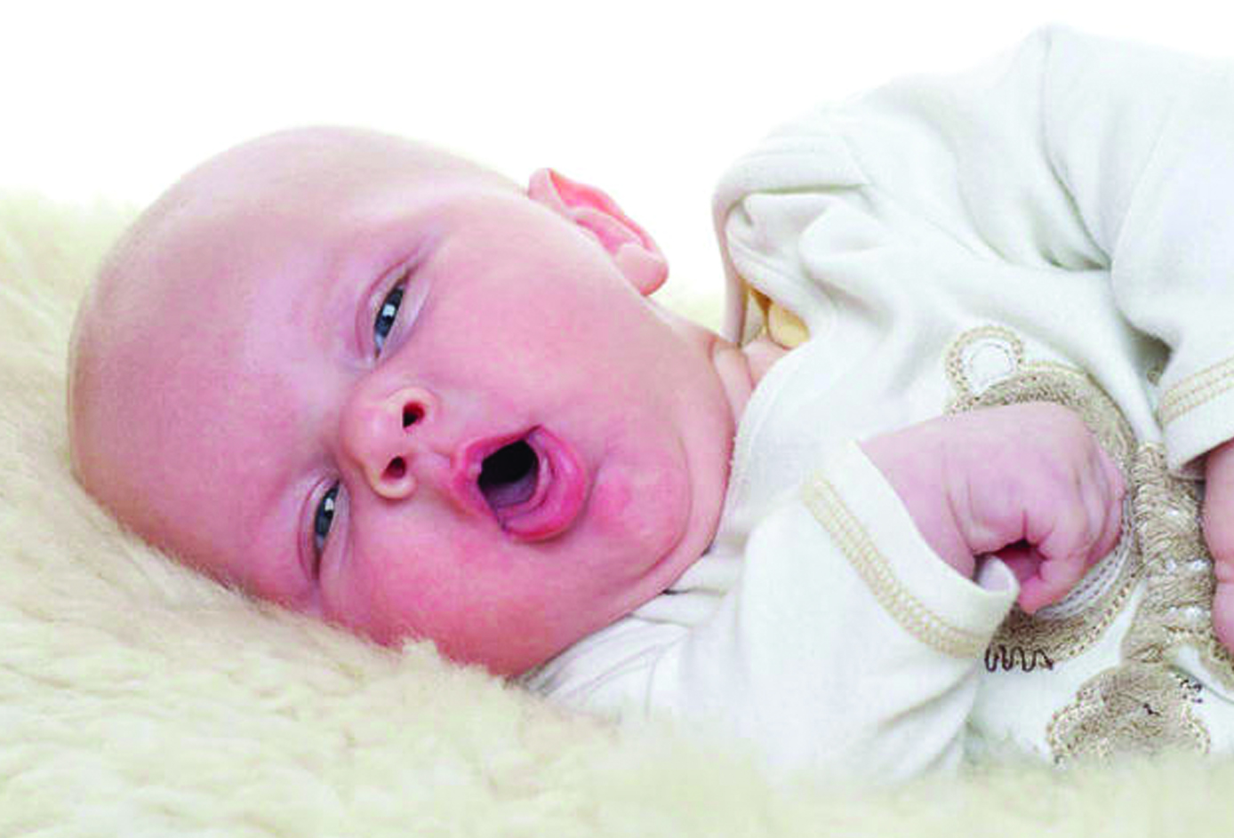 الأزيز التنفسي عند الأطفال الرضع