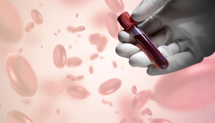 تحليل الهابتوغلوبين في الدم
