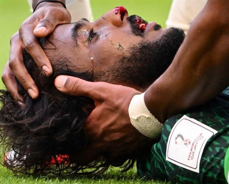 أحدث أخبار الحالة الصحية للمدافع السعودي ياسر الشهراني بعد الإصابة وهل سيغيب عن كاس العالم 2022
