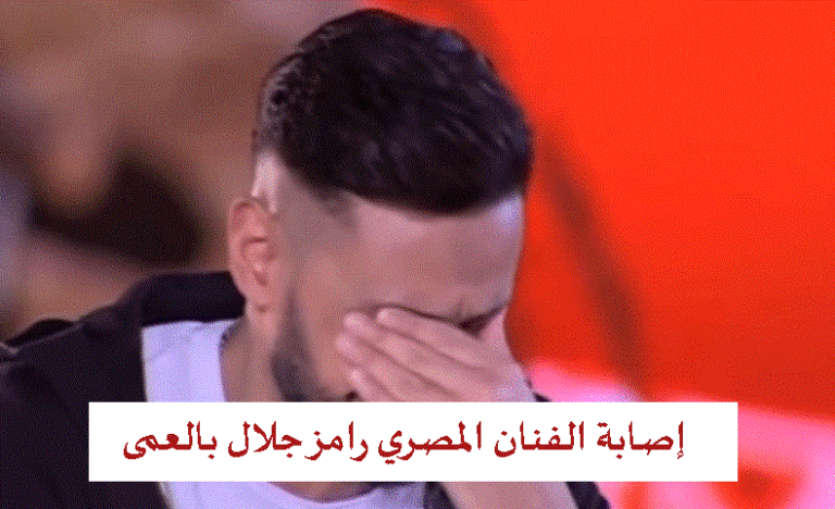 إصابة الفنان المصري رامز جلال بالعمى