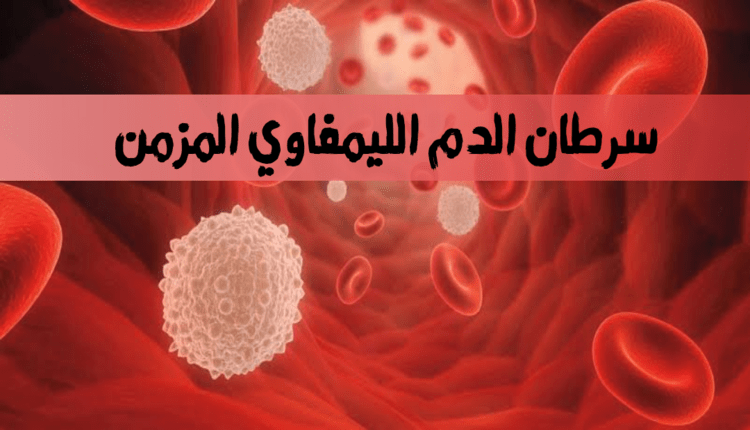 مرض سرطان الدم الليمفاوي المزمن